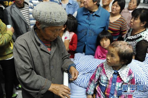 贵州金沙用开水浇头虐待女儿父亲被刑事拘留